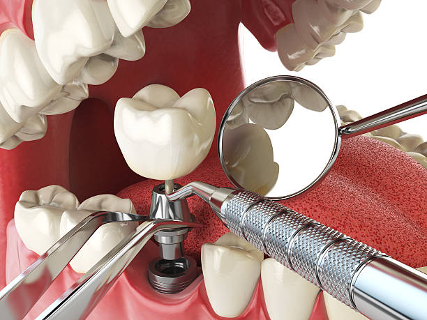 Best Emergency Treatment for Jaw Pain or Injury in Cut Bank, MT